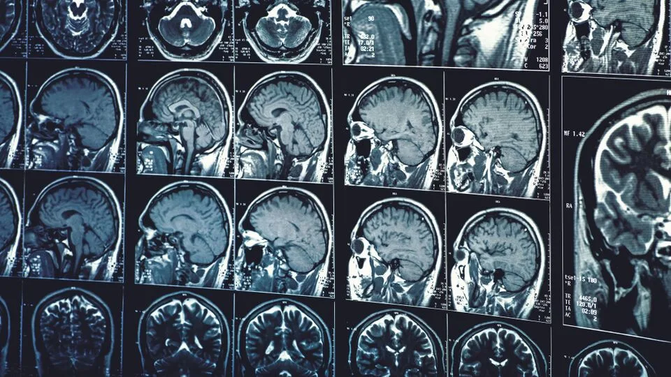 Male brain may continue maturing until age 32, neurologist says